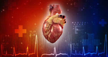 heart disease in Fabry patients