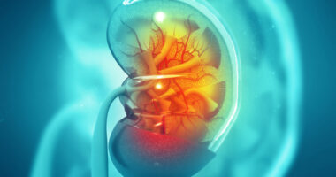 early ERT linked to better outcomes/fabrydiseasenews.com/chronic kidney disease