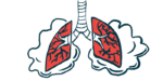 classic Fabry | Fabry Disease News | lung health | illustration of person's lungs