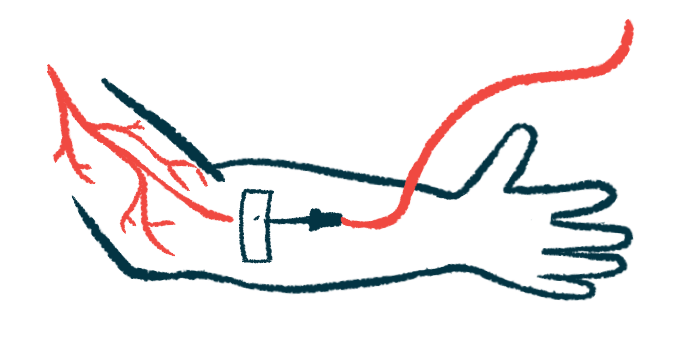 Illustration of an arm receiving intravenous treatment