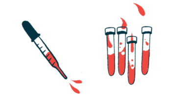 A squirting dropper is shown alongside four vials half-filled with blood.