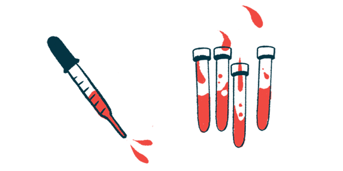 A squirting dropper is shown alongside four vials half-filled with blood.