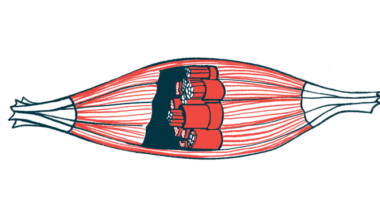 An illustration shows the bands of a muscle in cross-section.