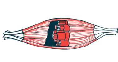 An illustration shows the bands of a muscle in cross-section.