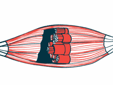 An illustration shows the bands of a muscle in cross-section.