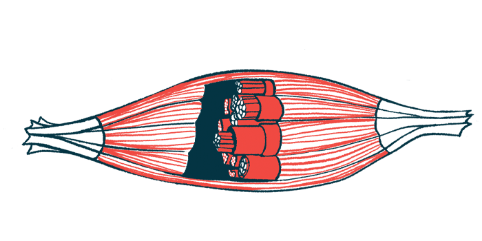 An illustration shows the bands of a muscle in cross-section.