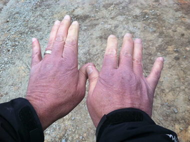 A photo is taken from the perspective of a man looking down at his hands. He's holding both of them out in front of him above a sidewalk and wearing long black sleeves. Both of his hands are a deep purplish color, while his fingertips, up until the second knuckles, are pale white.