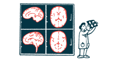 Images of a brain are shown as a scientist looks at a slide.