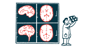 Images of a brain are shown as a scientist looks at a slide.