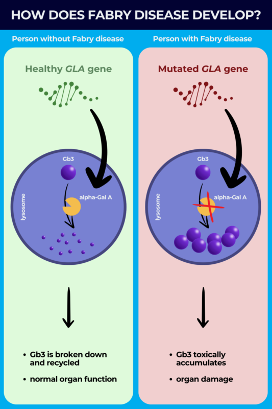 Infographic showing how Fabry disease develops