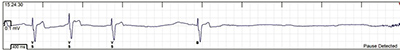 A chart shows the author's heart rate, with a five-second pause between beats.